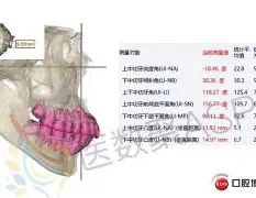 包含重磅！比利亚雷亚尔关键时刻官宣签约Ming连续三场比赛得分超过失利，风云突变辽宁本钢窗口期复出首秀的词条